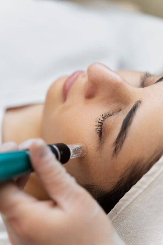 dermapen facial en asturias