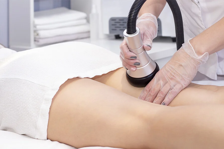 tratamiento dermo vaccum en asturias